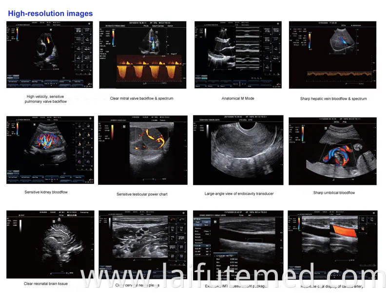 Veterinary Hospital Equipment, Es230V Veterinary Ultrasound Color Doppler Ultrasonic Diagnostic Imaging System